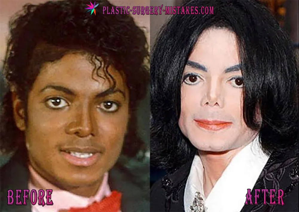 Michael Jackson Before and After Plastic Surgery Michael Jackson Before And After Plastic Surgery