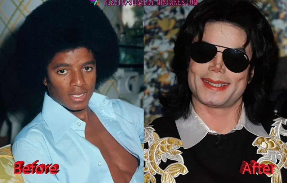 Michael Jackson Plastic Surgery: The Tragic, Jaw-Dropping Truth Behind the King of Popβs Changing Face ππͺ