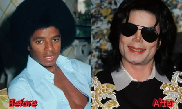 Michael Jackson Plastic Surgery: The Tragic, Jaw-Dropping Truth Behind the King of Pop’s Changing Face 👑🔪