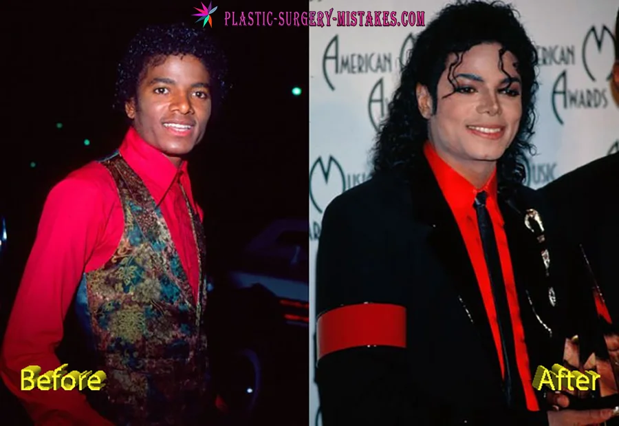 Michael Jackson Plastic Surgery Before and After Michael Jackson Plastic Surgery Before And After
