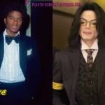 Michael Jackson Plastic Surgery Disaster