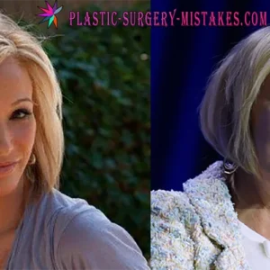 Paula White Before and After Plastic Surgery