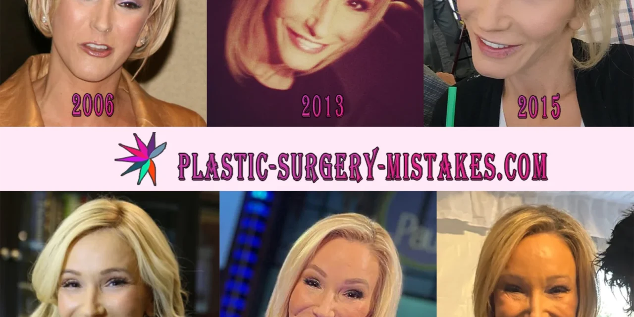 Paula White Plastic Surgery: Facelift, Fillers & Rumors 💉✨