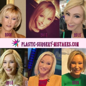 Paula White Plastic Surgery Timeline