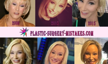 Paula White Plastic Surgery: Facelift, Fillers & Rumors 💉✨