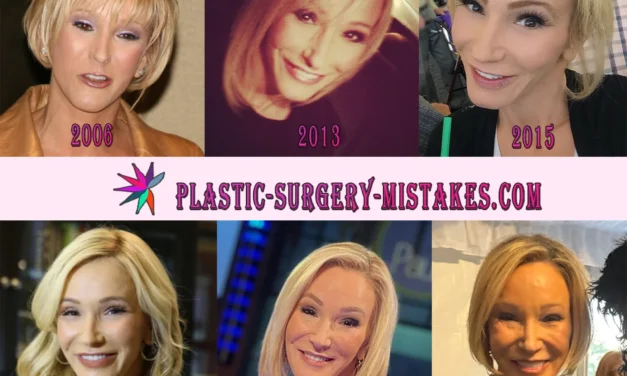 Paula White Plastic Surgery: Facelift, Fillers & Rumors 💉✨
