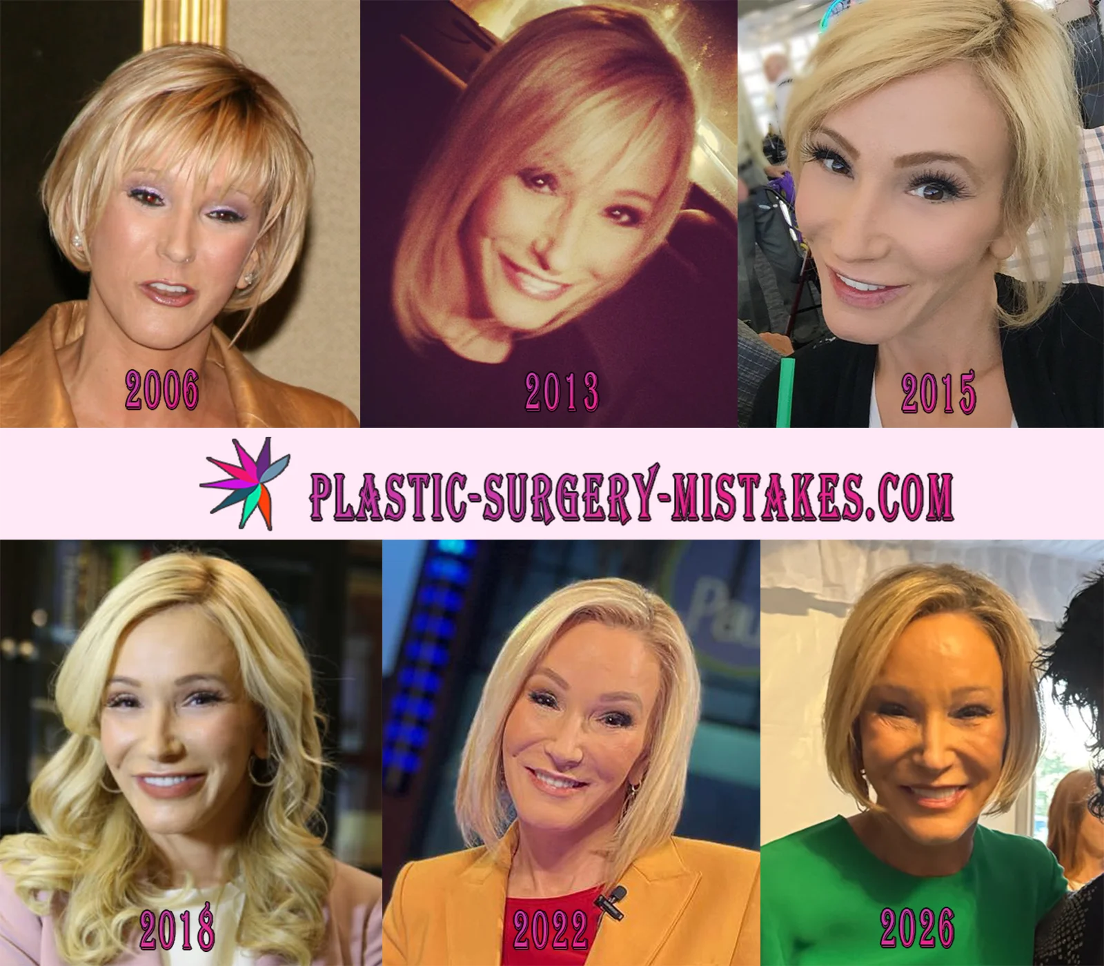 Paula White Plastic Surgery Timeline Paula White Plastic Surgery Timeline