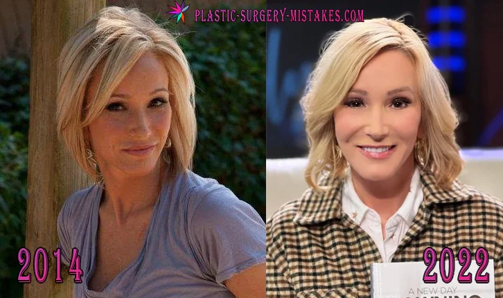 Paula White face transformation comparing photos from 2014 and 2022. Paula White Face Transformation Comparing Photos From 2014 And 2022