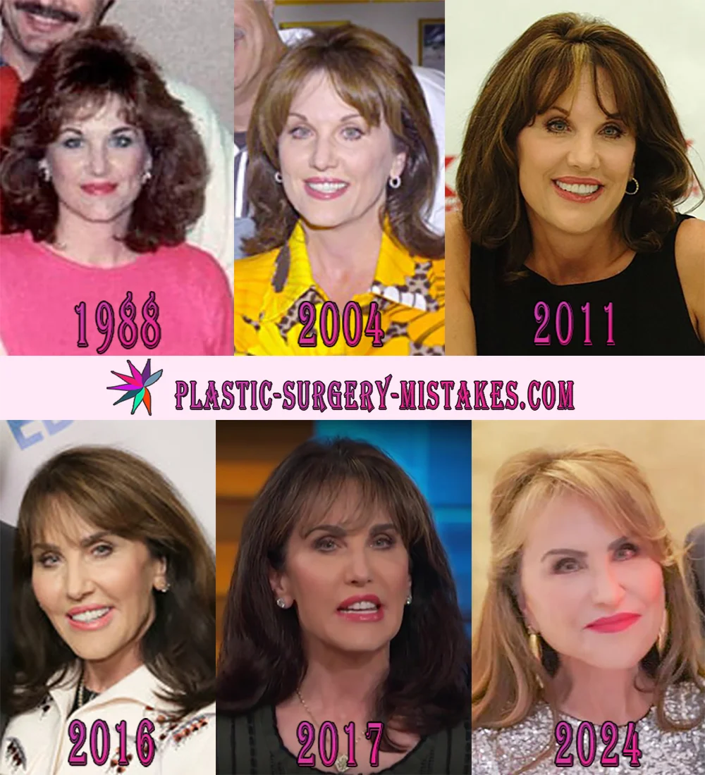 Robin McGraw Plastic Surgery Transformation over the Years Robin McGraw Before and After Plastic Surgery