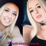 Tana Mongeau Before And After Plastic Surgery Tana Mongeau Before And After Plastic Surgery
