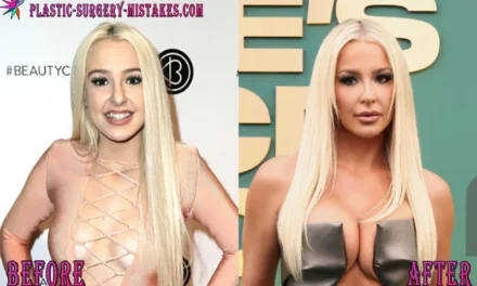 Tana Mongeau Plastic Surgery Timeline: The Truth Behind Her Unreal Transformation 💋
