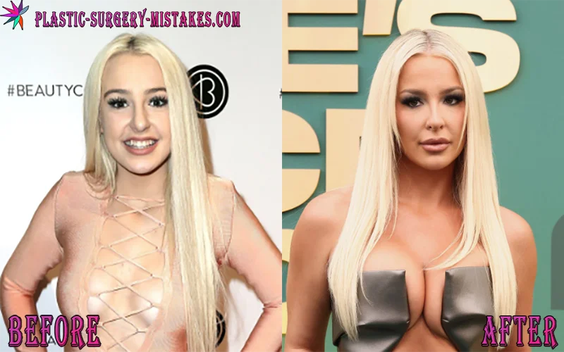 Tana Mongeau Plastic Surgery Timeline: The Truth Behind Her Unreal Transformation π