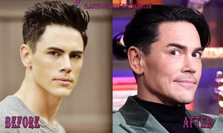 Tom Sandoval Plastic Surgery: The Shocking Truth! 💉