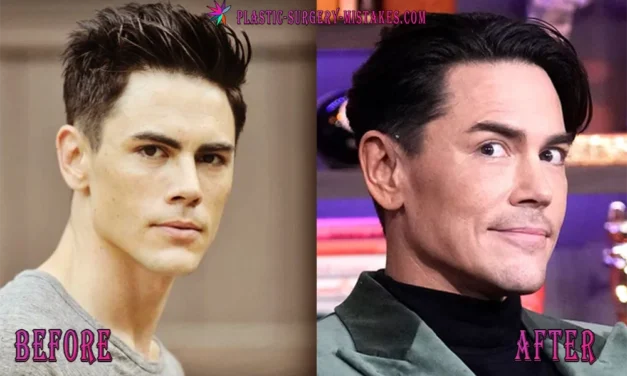 Tom Sandoval Plastic Surgery: The Shocking Truth! 💉