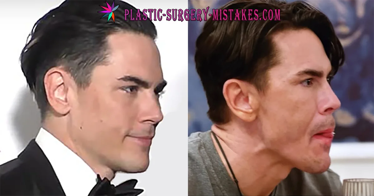 Tom Sandoval Before and After Tom Sandoval Before And After