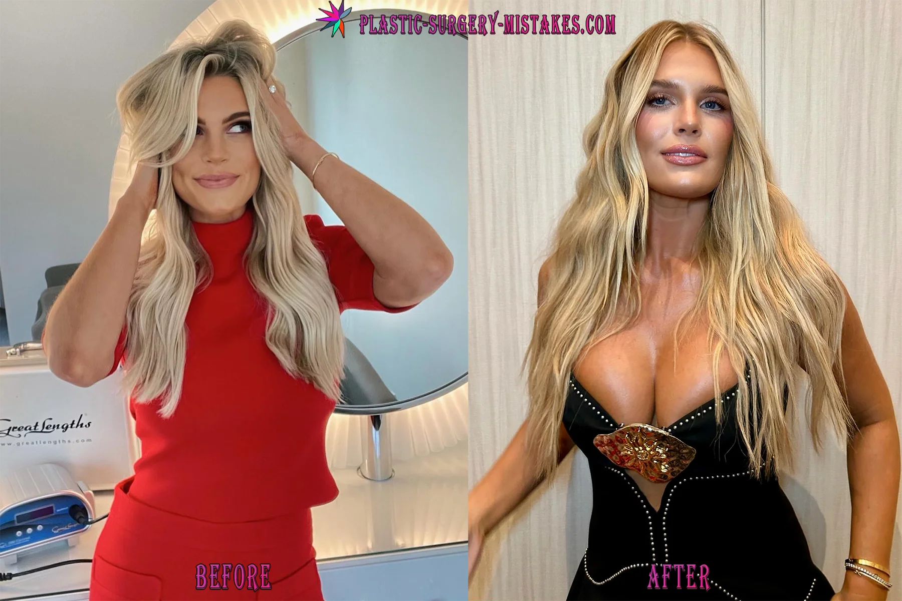 madison lecroy breast augmentation before and after Madison Lecroy Breast Augmentation Before And After