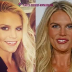 Madison Lecroy Lip Fillers And Face Transformation Madison Lecroy Lip Fillers And Face Transformation