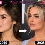 Addison Rae Plastic Surgery: The Nose Job, Fillers & 2026 Glow-Up Rumors Explained