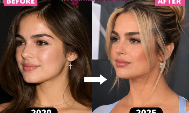 Addison Rae Plastic Surgery: The Nose Job, Fillers & 2026 Glow-Up Rumors Explained