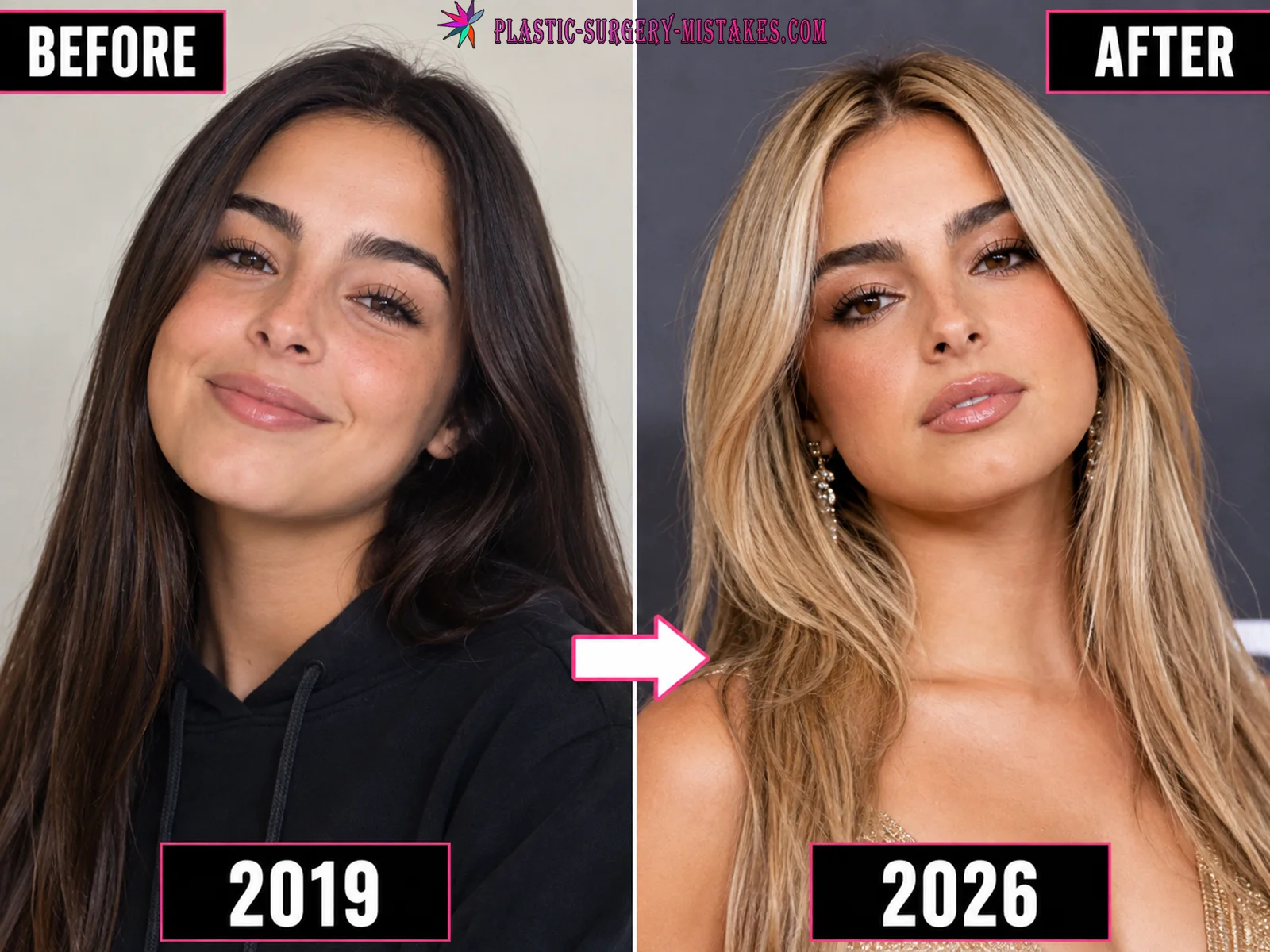 Addison Rae Before And After Plastic Surgery