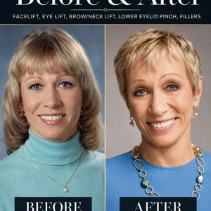 Barbara Corcoran Before and After