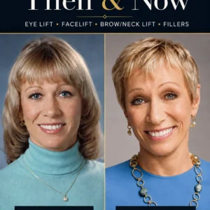 Barbara Corcoran Cosmetic Procedures Then and Now