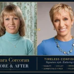 Barbara Corcoran Plastic Surgery: 3 Facelifts, Eye Lifts & Her Wild Ear Filler Secret