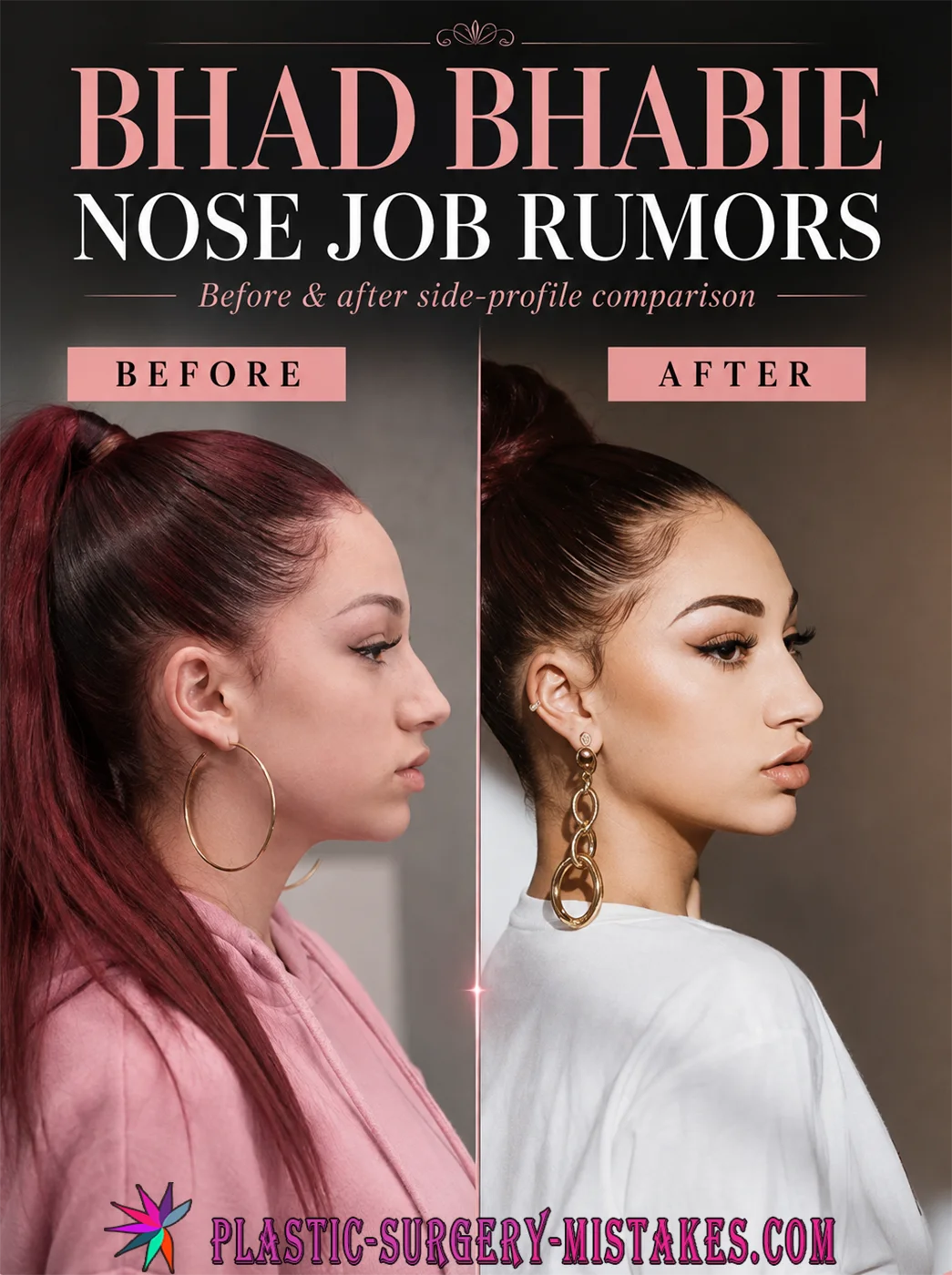 Bhad Bhabie Before And After Nose Job Plastic Surgery