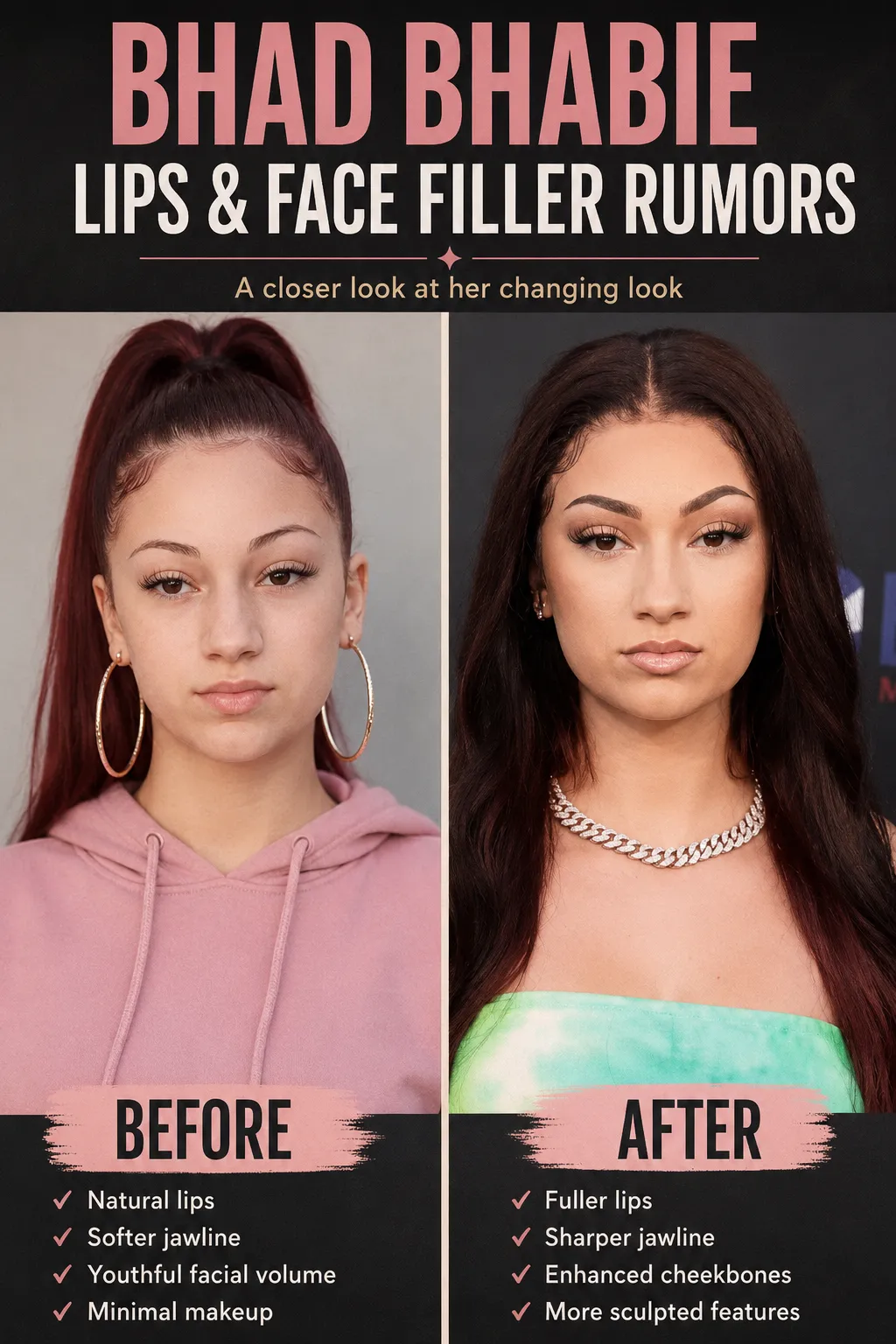 Bhad Bhabie Lips And Filler Rumors
