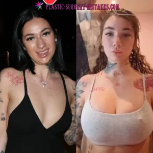 Bhad Bharbie Before and After Boob Job