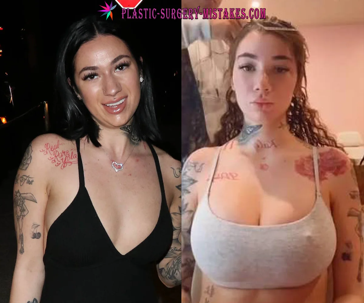 Bhad Bharbie Before And After Boob Job