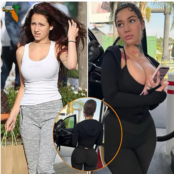 Bhad Bharbie Before And After Plastic Surgery