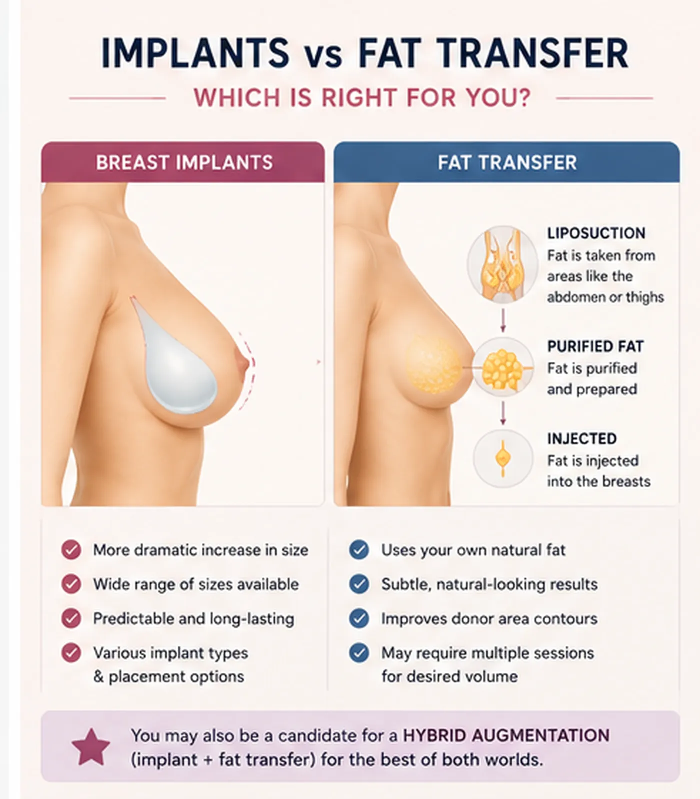 Breast Augmentation - IMPLANTS vs FAT TRANSFER Breast Augmentation IMPLANTS Vs FAT TRANSFER