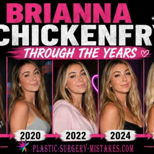 Brianna Chickenfry Plastic Surgery Through The Years