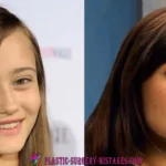 👀 Did Ella Purnell Get Plastic Surgery? The Truth Behind Her Giant Eyes & Fallout Transformation 💉