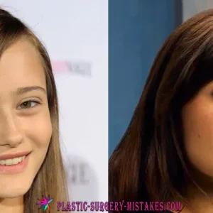 Ella Purnell Plastic Surgery Before and After