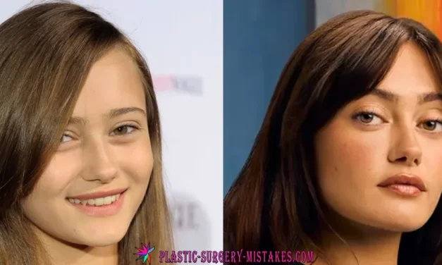 👀 Did Ella Purnell Get Plastic Surgery? The Truth Behind Her Giant Eyes & Fallout Transformation 💉