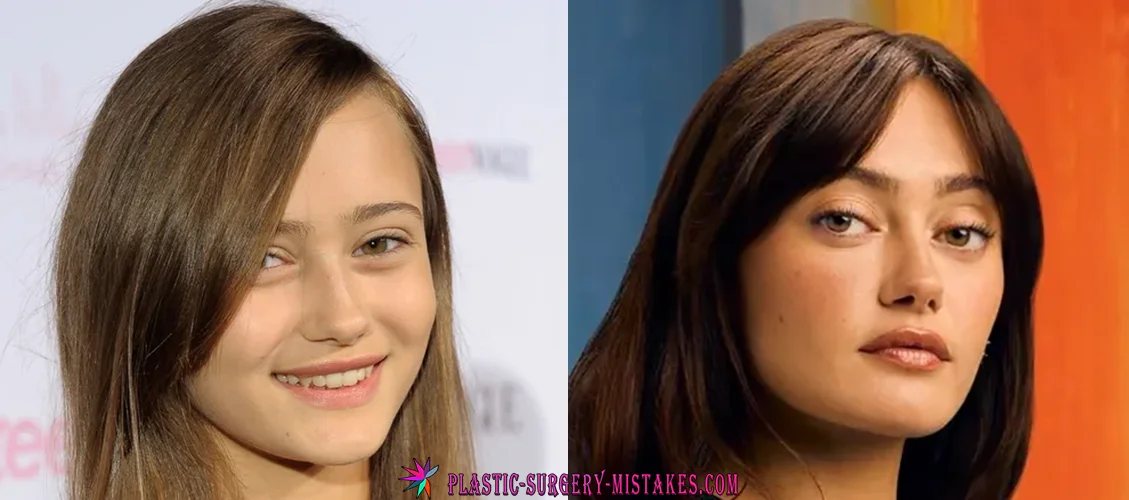 ๐ Did Ella Purnell Get Plastic Surgery? The Truth Behind Her Giant Eyes & Fallout Transformation ๐