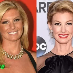 Faith Hill Before and After Plastic Surgery