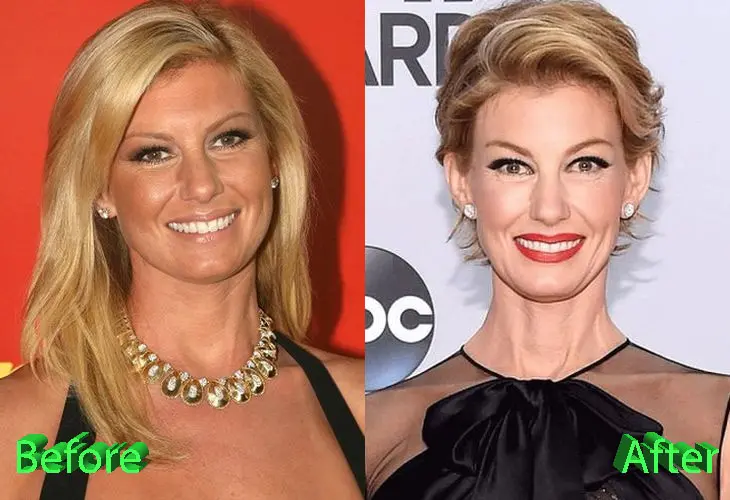 Faith Hill Before and After Plastic Surgery Faith Hill Before And After Plastic Surgery