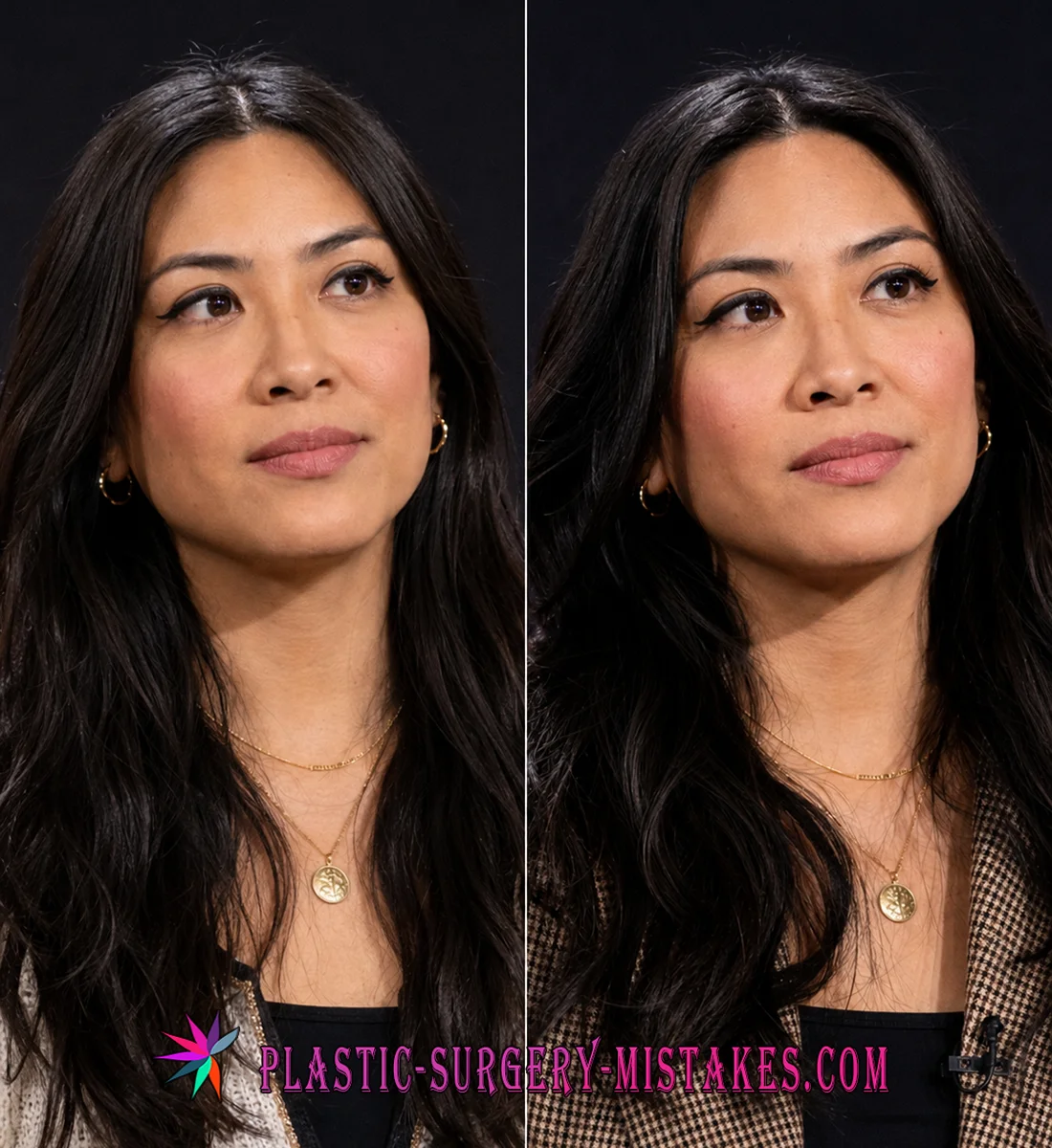 Jia Tolentino Before And After Face Comparison