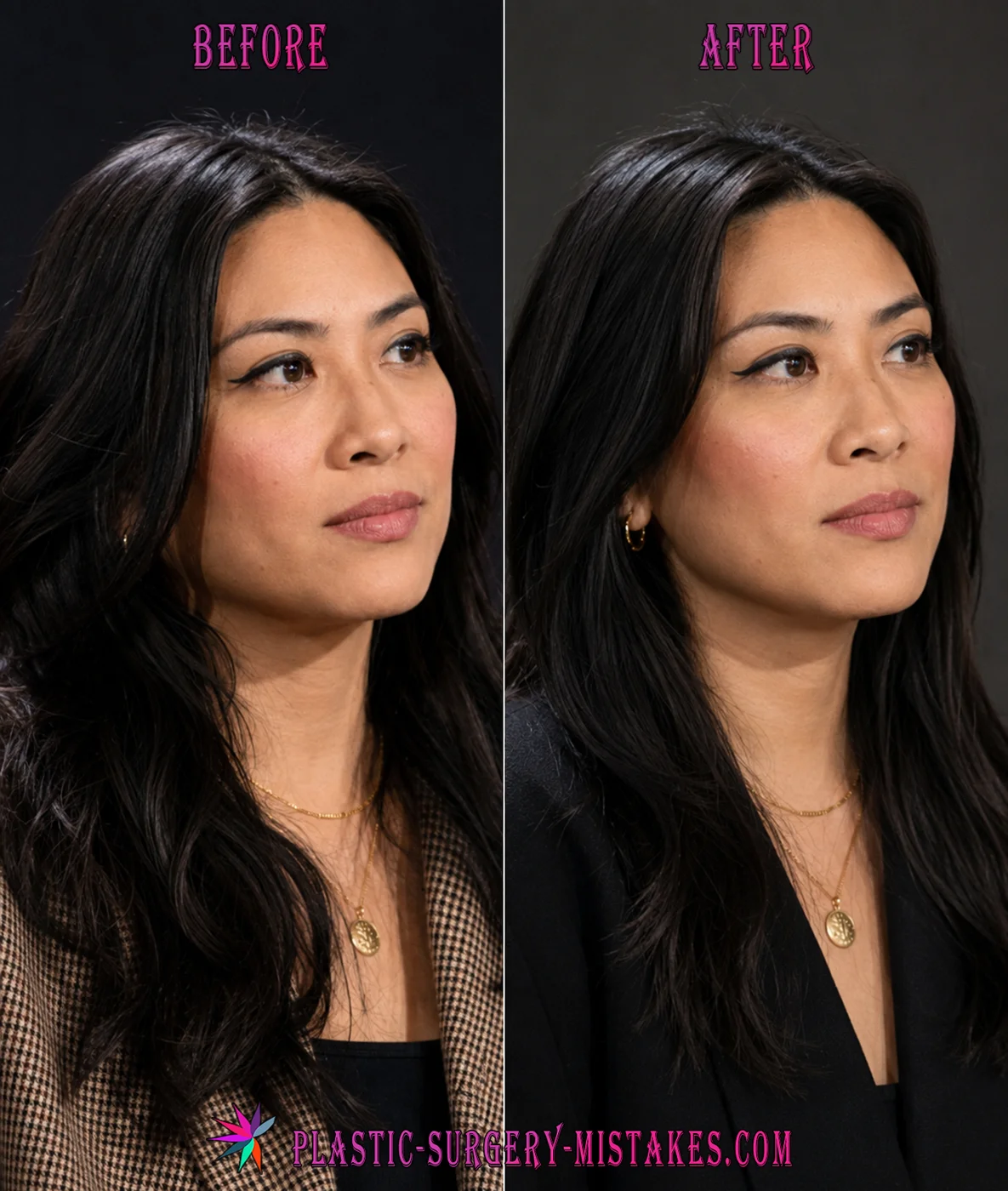 Jia Tolentino Facial Changes Before And After