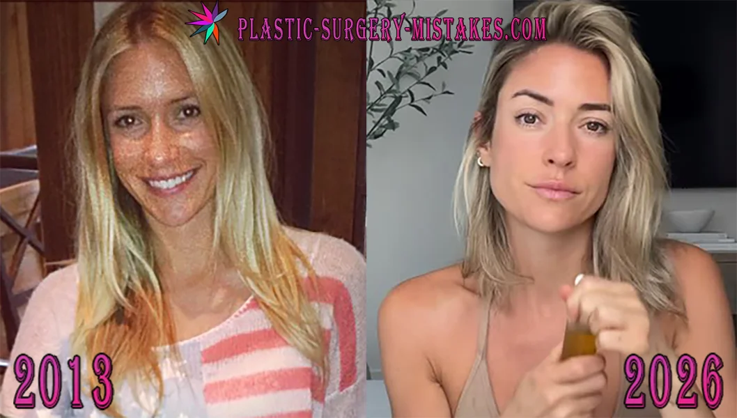 Kristin Cavallari Plastic Surgery Kristin Cavallari Plastic Surgery