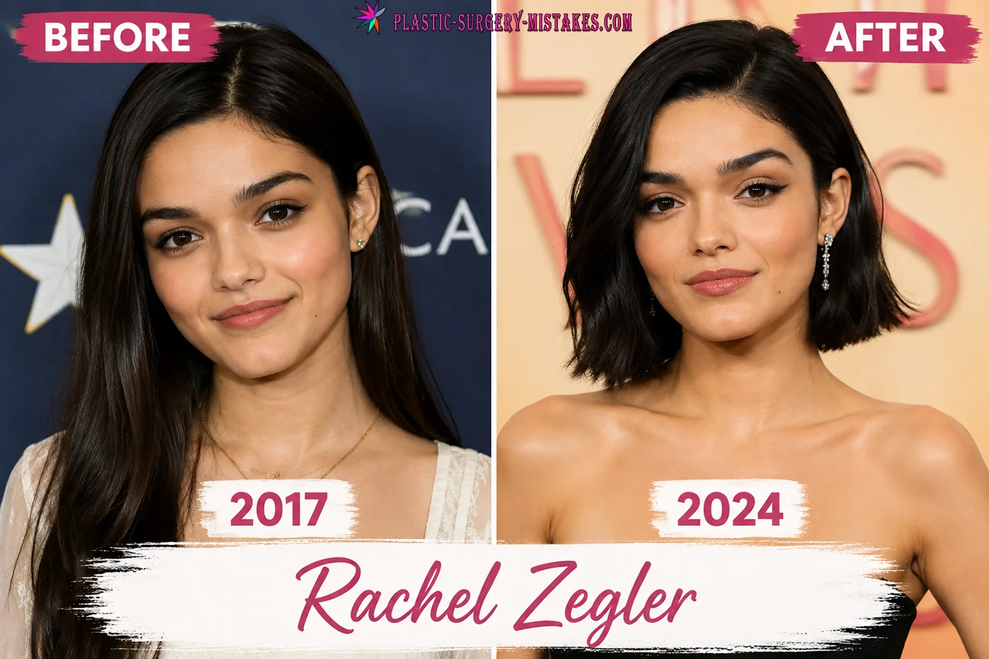 Rachel Zegler Plastic Surgery Rachel Zegler Plastic Surgery