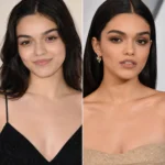 Rachel Zegler Plastic Surgery Rumors Explode After 2026 Met Gala — What She’s Actually Said