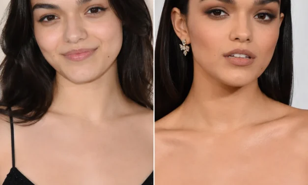 Rachel Zegler Plastic Surgery Rumors Explode After 2026 Met Gala — What She’s Actually Said