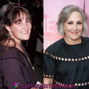 Ricki Lake Before and After