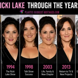 Ricki Lake Plastic Surgery Through The Years