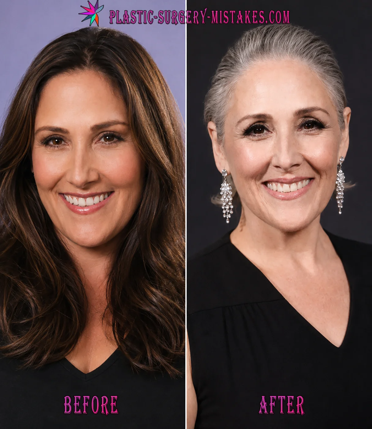 Ricki Lake Plastic Surgery Ricki Lake Plastic Surgery