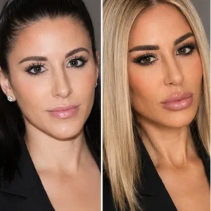 Shekinah Plastic Surgery Before And After